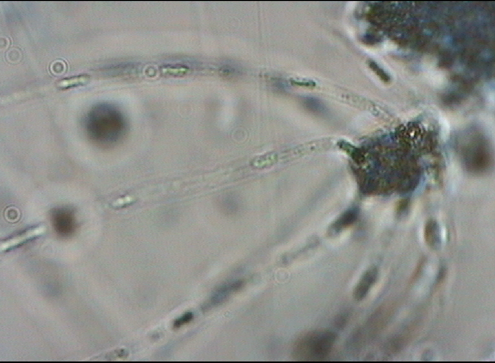 Dictyocha speculum